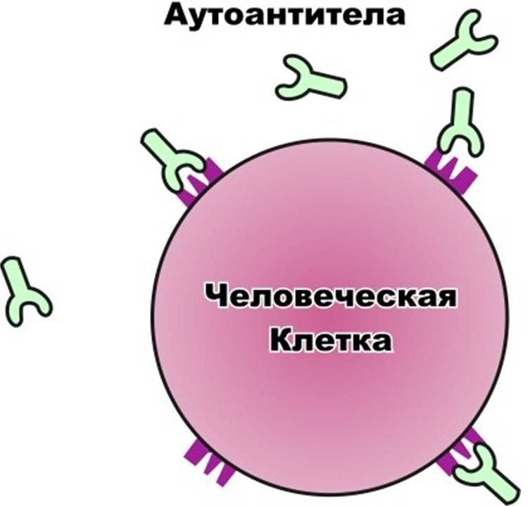 Сахарный диабет первого типа картинки